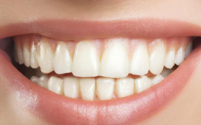 Denti Bianchi  La Guida Definitiva per un Sorriso Smagliante